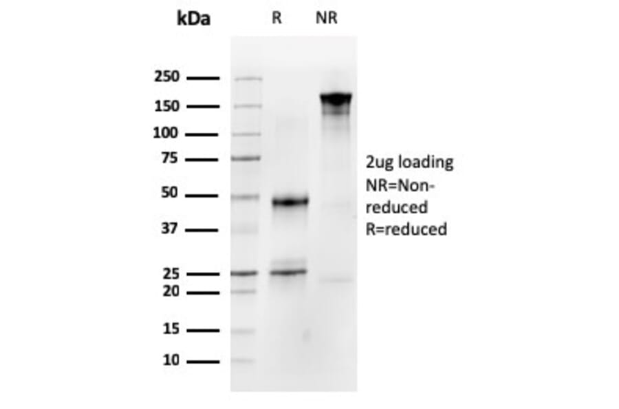 SDS-PAGE - Anti-Occludin Antibody [OCLN/2183] (A248064) - Antibodies.com