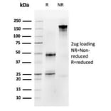 SDS-PAGE - Anti-Occludin Antibody [OCLN/2183] (A248064) - Antibodies.com