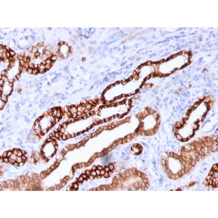 Immunohistochemistry - Anti-Cadherin 16 Antibody [CDH16/1071] (A248065) - Antibodies.com