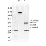 SDS-PAGE - Anti-Cadherin 16 Antibody [CDH16/1071] (A248065) - Antibodies.com