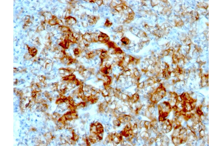Immunohistochemistry - Anti-Cadherin 16 Antibody [SPM594] (A248065) - Antibodies.com