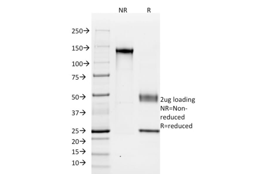 SDS-PAGE - Anti-Cadherin 16 Antibody [SPM594] (A248066) - Antibodies.com
