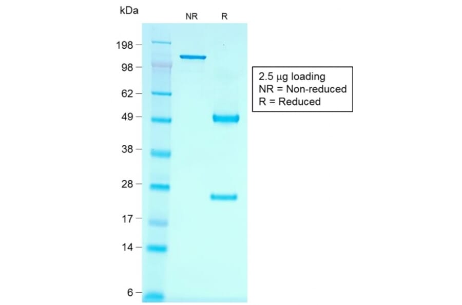 SDS-PAGE - Anti-Cadherin 16 Antibody [rCDH16/1071] (A248067) - Antibodies.com