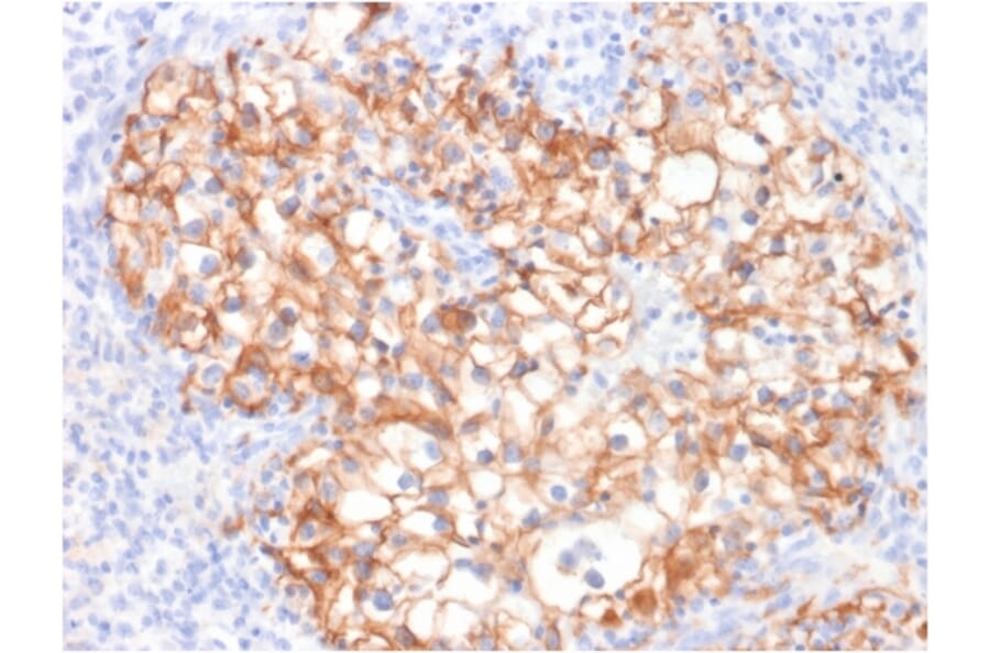 Immunohistochemistry - Anti-Cadherin 16 Antibody [CDH16/2125] (A248068) - Antibodies.com