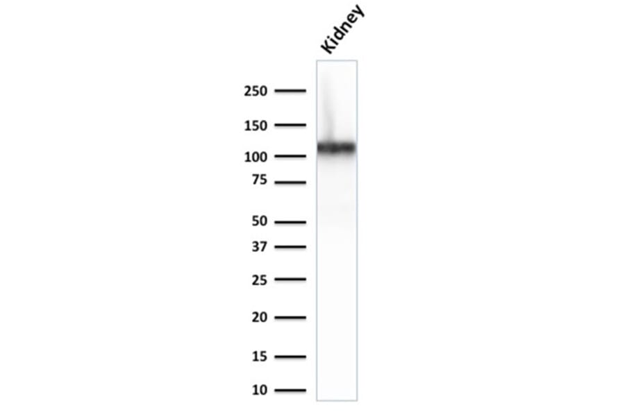 Western Blot - Anti-Cadherin 16 Antibody [CDH16/2125] (A248068) - Antibodies.com