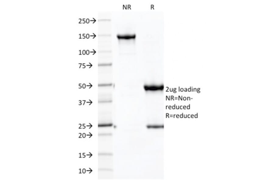 SDS-PAGE - Anti-Cadherin 16 Antibody [CDH16/2125] (A248068) - Antibodies.com