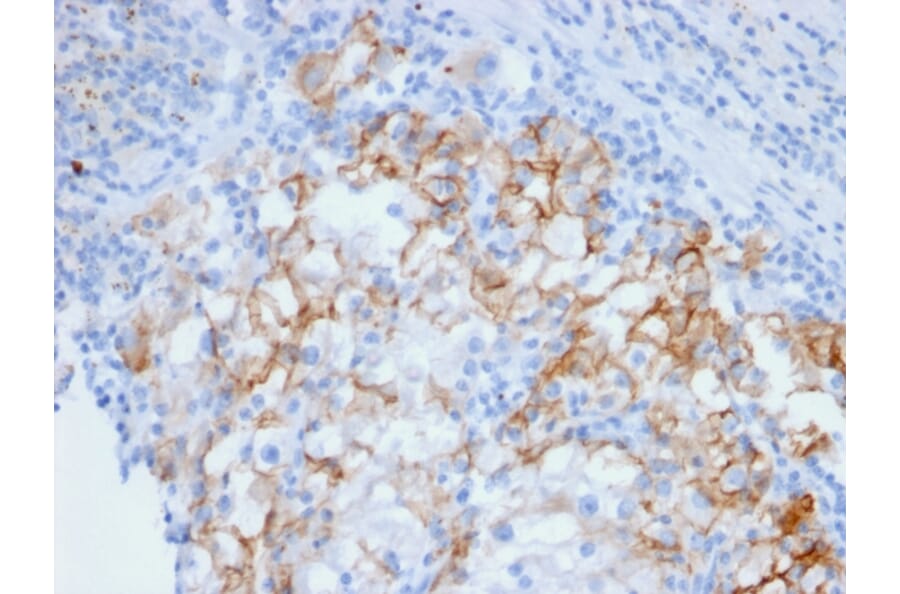 Immunohistochemistry - Anti-Cadherin 16 Antibody [CDH16/2448] (A248069) - Antibodies.com