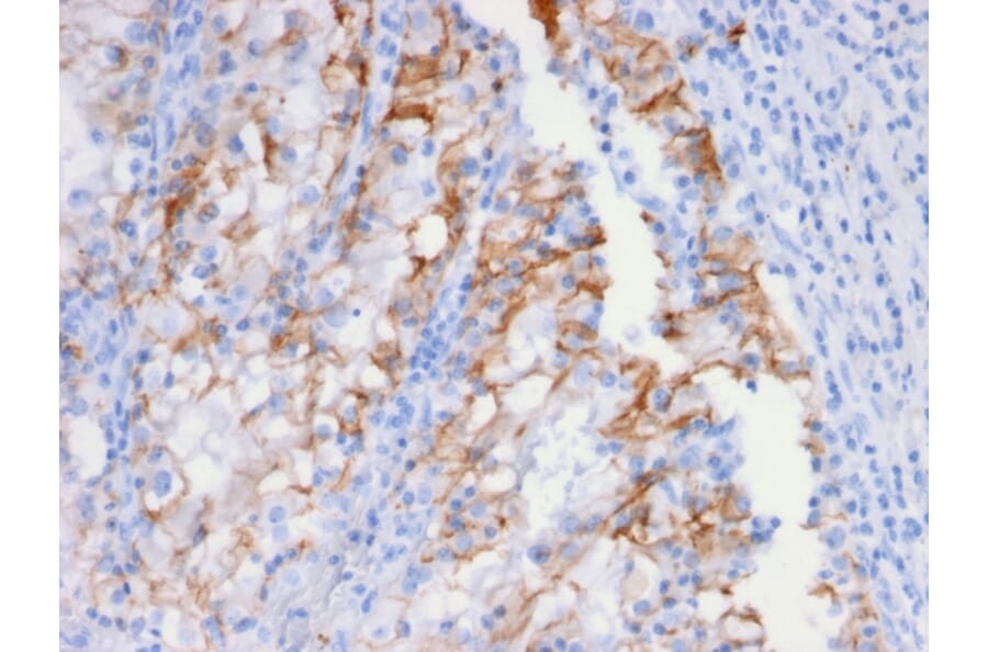 Immunohistochemistry - Anti-Cadherin 16 Antibody [CDH16/2448] (A248069) - Antibodies.com