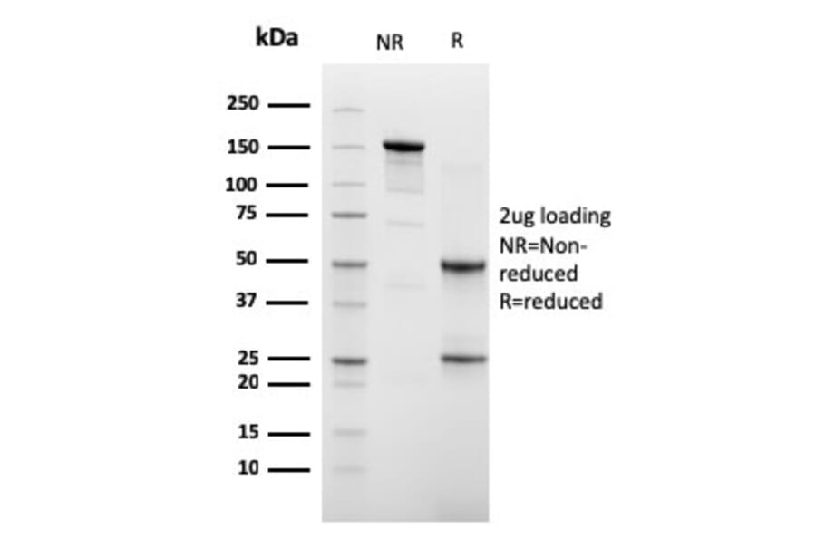 SDS-PAGE - Anti-Cadherin 16 Antibody [CDH16/2448] (A248069) - Antibodies.com