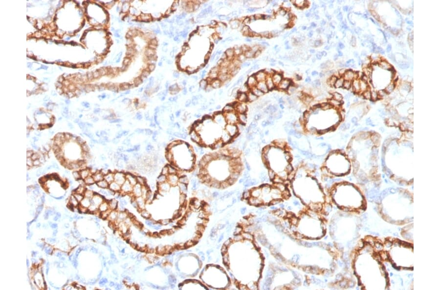 Immunohistochemistry - Anti-Cadherin 16 Antibody [CDH16/1532R] (A248070) - Antibodies.com
