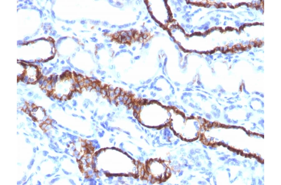 Immunohistochemistry - Anti-Cadherin 16 Antibody [CDH16/1532R] (A248070) - Antibodies.com