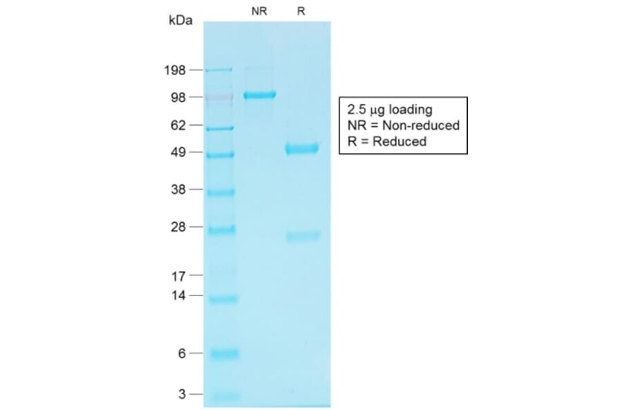 SDS-PAGE - Anti-Cadherin 16 Antibody [CDH16/1532R] (A248070) - Antibodies.com
