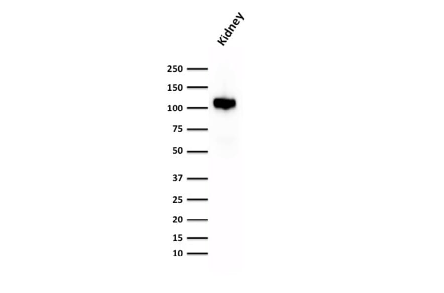 Western Blot - Anti-Cadherin 16 Antibody [CDH16/1532R] (A248070) - Antibodies.com