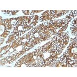 Immunohistochemistry - Anti-LI Cadherin Antibody [CDH17/2615] (A248072) - Antibodies.com
