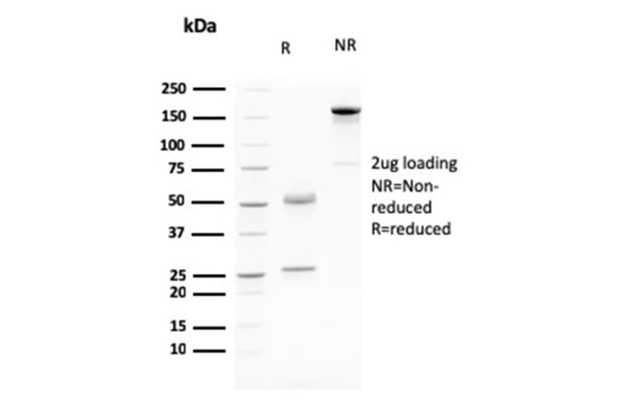 SDS-PAGE - Anti-LI Cadherin Antibody [CDH17/2615] (A248072) - Antibodies.com