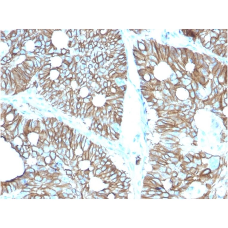Immunohistochemistry - Anti-LI Cadherin Antibody [CDH17/2616] (A248073) - Antibodies.com