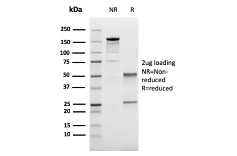 SDS-PAGE - Anti-LI Cadherin Antibody [CDH17/2616] (A248073) - Antibodies.com