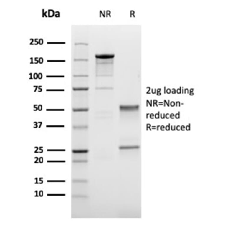 SDS-PAGE - Anti-LI Cadherin Antibody [CDH17/2616] (A248073) - Antibodies.com