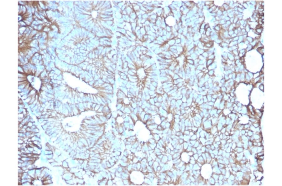 Immunohistochemistry - Anti-LI Cadherin Antibody [CDH17/2617] (A248074) - Antibodies.com