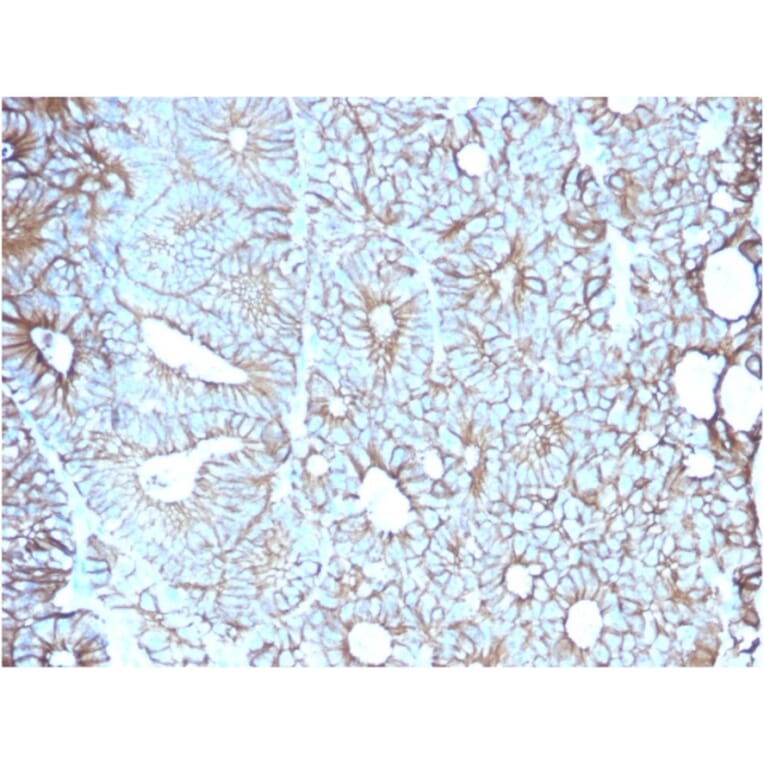 Immunohistochemistry - Anti-LI Cadherin Antibody [CDH17/2617] (A248074) - Antibodies.com