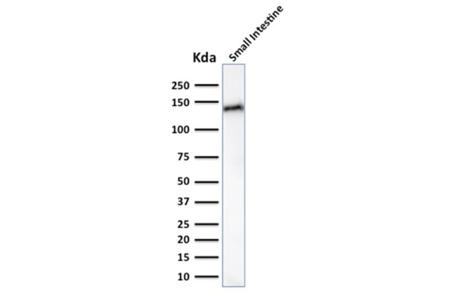 Western Blot - Anti-LI Cadherin Antibody [CDH17/2617] (A248074) - Antibodies.com