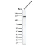 Western Blot - Anti-LI Cadherin Antibody [CDH17/2617] (A248074) - Antibodies.com