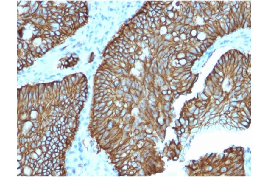 Immunohistochemistry - Anti-LI Cadherin Antibody [CDH17/2618] (A248075) - Antibodies.com