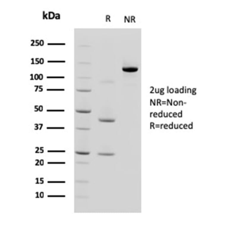 SDS-PAGE - Anti-LI Cadherin Antibody [CDH17/2618] (A248075) - Antibodies.com