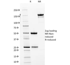SDS-PAGE - Anti-CDK2 Antibody [AN4.3] (A248075) - Antibodies.com
