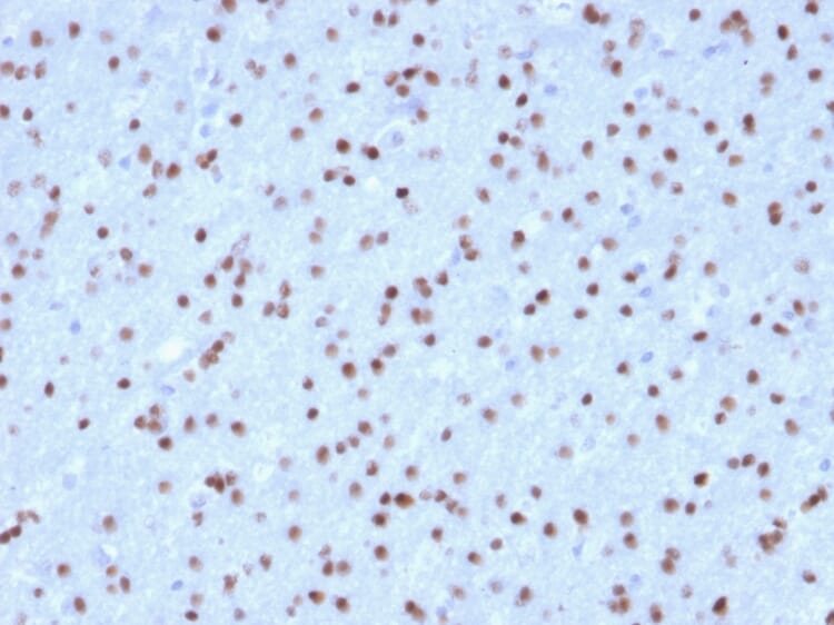 Anti-OLIG2 Antibody [OLIG2/2400] (A248077) | Antibodies.com
