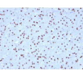 Immunohistochemistry - Anti-OLIG2 Antibody [OLIG2/2400] (A248077) - Antibodies.com