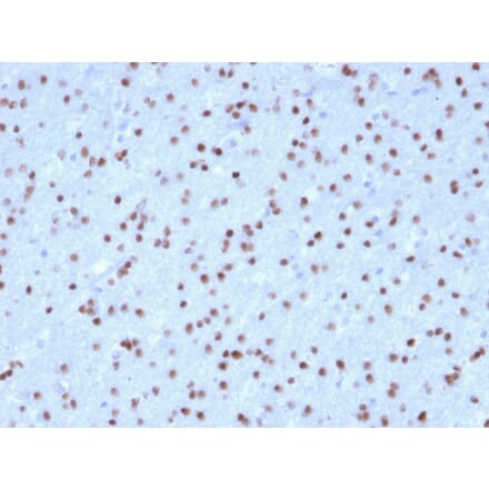 Immunohistochemistry - Anti-OLIG2 Antibody [OLIG2/2400] (A248077) - Antibodies.com