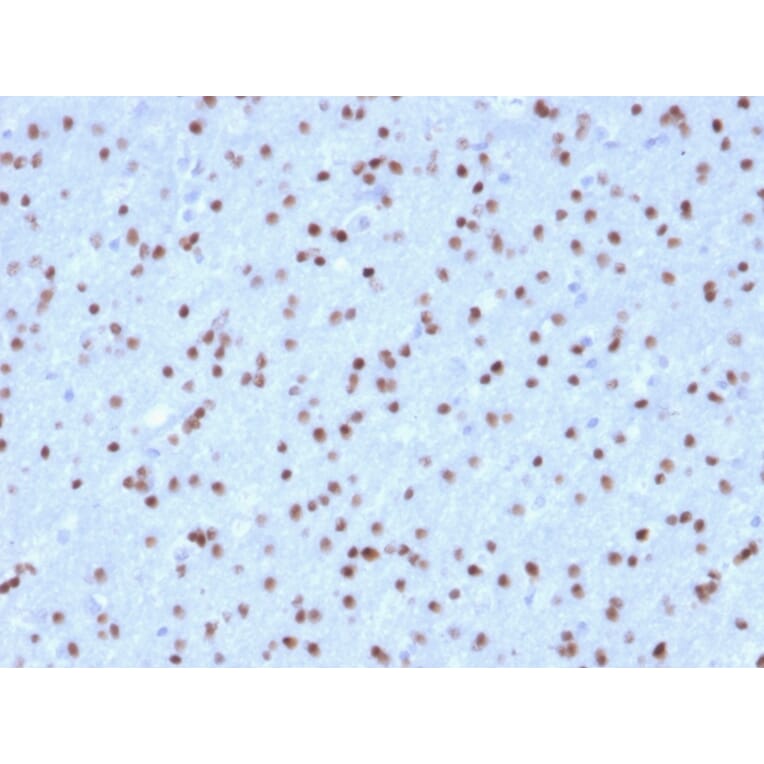 Immunohistochemistry - Anti-OLIG2 Antibody [OLIG2/2400] (A248077) - Antibodies.com