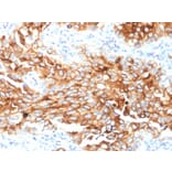 Immunohistochemistry - Anti-Mesothelin Antibody [MSLN/2131] (A248078) - Antibodies.com