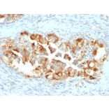 Immunohistochemistry - Anti-Mesothelin Antibody [MSLN/2131] (A248078) - Antibodies.com