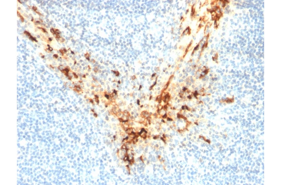 Immunohistochemistry - Anti-Mesothelin Antibody [MSLN/2131] (A248078) - Antibodies.com