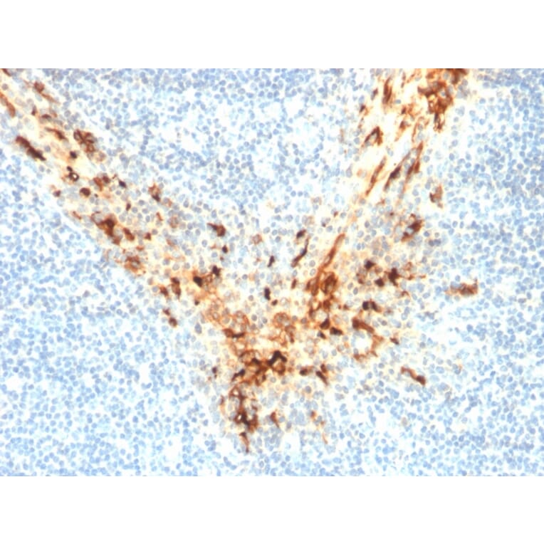 Immunohistochemistry - Anti-Mesothelin Antibody [MSLN/2131] (A248078) - Antibodies.com