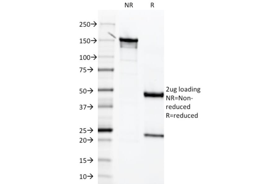 SDS-PAGE - Anti-Mesothelin Antibody [MSLN/2131] (A248078) - Antibodies.com