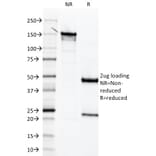 SDS-PAGE - Anti-Mesothelin Antibody [MSLN/2131] (A248078) - Antibodies.com