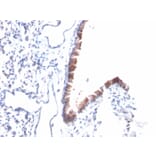 Immunohistochemistry - Anti-Mesothelin Antibody [MSLN/2131] (A248078) - Antibodies.com