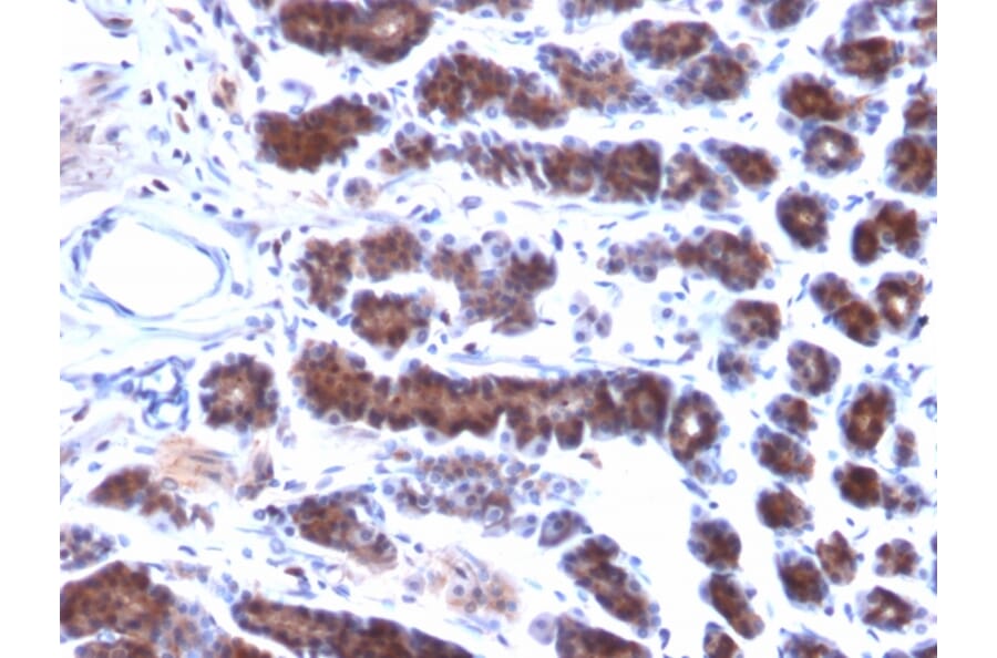 Immunohistochemistry - Anti-Mesothelin Antibody [MSLN/2131] (A248078) - Antibodies.com