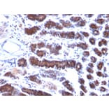 Immunohistochemistry - Anti-Mesothelin Antibody [MSLN/2131] (A248078) - Antibodies.com