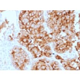 Immunohistochemistry - Anti-Mesothelin Antibody [SPM143] (A248079) - Antibodies.com
