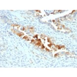 Immunohistochemistry - Anti-Mesothelin Antibody [SPM143] (A248078) - Antibodies.com