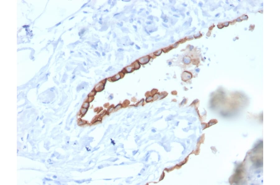 Immunohistochemistry - Anti-Mesothelin Antibody [MSLN/3384] (A248080) - Antibodies.com