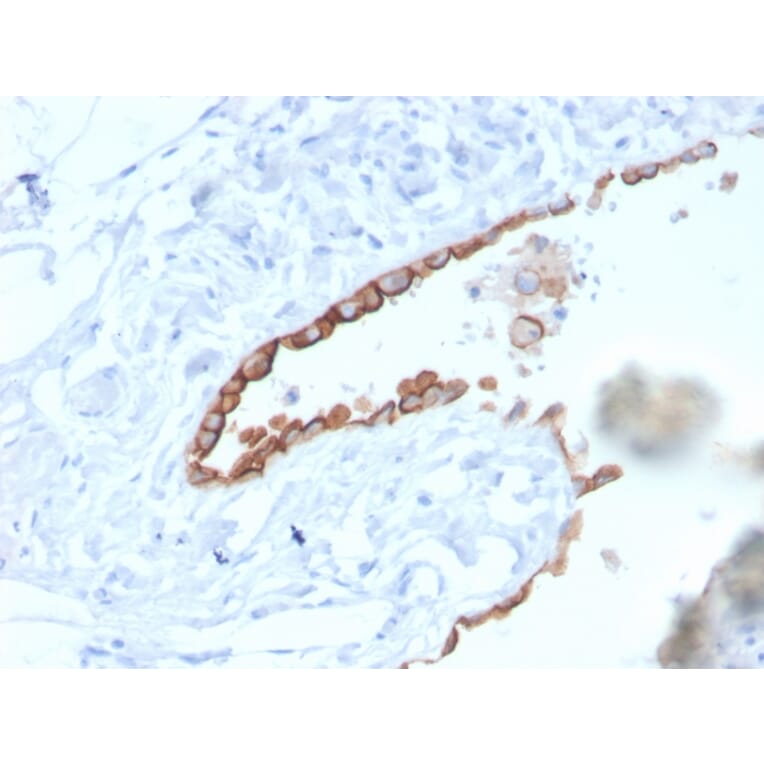 Immunohistochemistry - Anti-Mesothelin Antibody [MSLN/3384] (A248080) - Antibodies.com