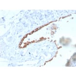 Immunohistochemistry - Anti-Mesothelin Antibody [MSLN/3384] (A248080) - Antibodies.com