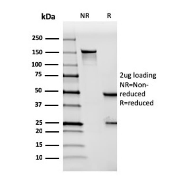 SDS-PAGE - Anti-Mesothelin Antibody [MSLN/3384] (A248080) - Antibodies.com