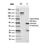 SDS-PAGE - Anti-Mesothelin Antibody [MSLN/3384] (A248080) - Antibodies.com