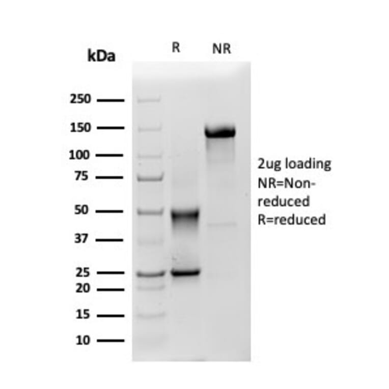 SDS-PAGE - Anti-Mesothelin Antibody [MSLN/3385] (A248081) - Antibodies.com